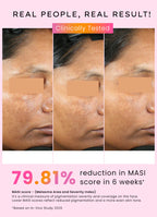 Dual phase de-pigmentation serum