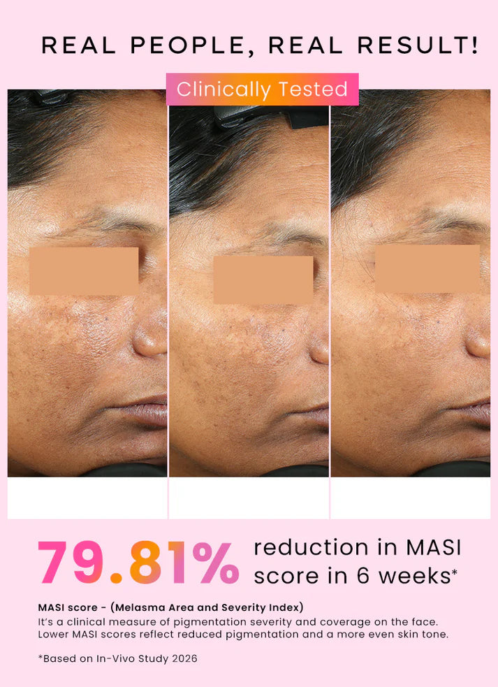 Dual phase de-pigmentation serum